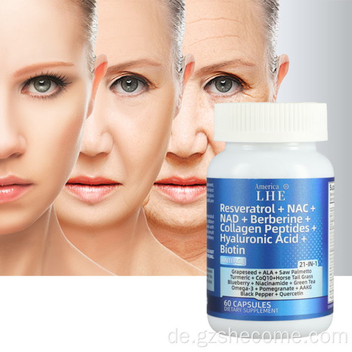 Neuankömmlinge NAD -Kapseln unterstützen die gemeinsame Gesundheit